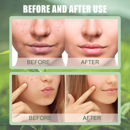 Green Tea Cleaning Solid Mask Stick - Acne Blackhead Remover Zen Aural