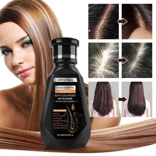 Hair Growth Shampoo Zen Aural